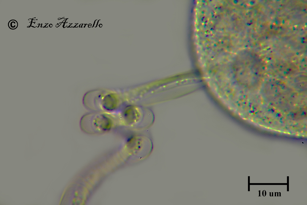 QUESTE FOTO MI PIACCIONO TROPPO! MIONEMA DI VORTICELLA 1000X